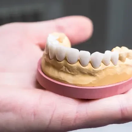 gebiss-implantat-Zahnarzt-modell-auf-hand-liegend-zahnimplantat-arten-dr-machon-nuertingen-zahnarzt