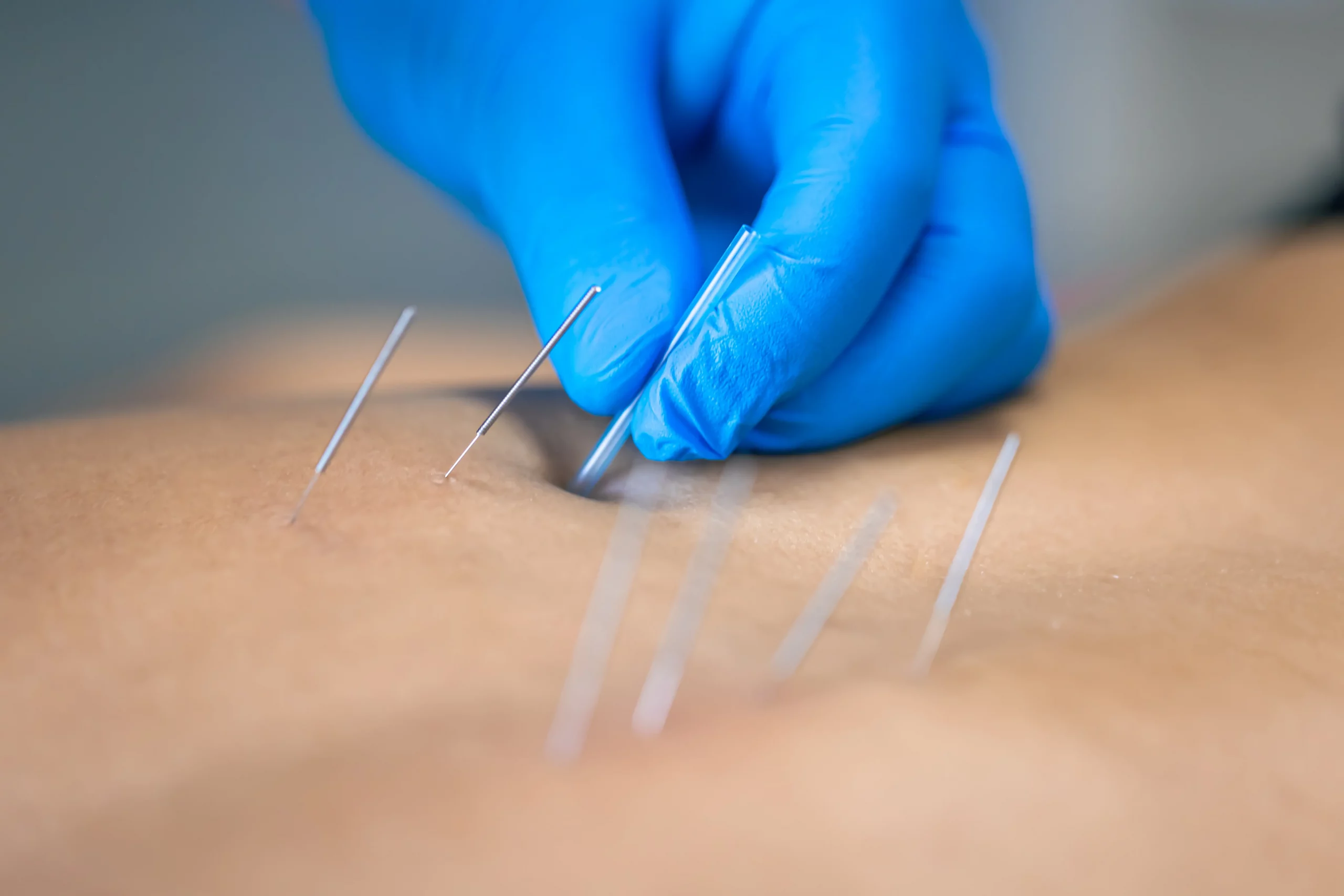 alternative-zahnmedizin-mit-akupunktur-zahn-organ-beziehung
